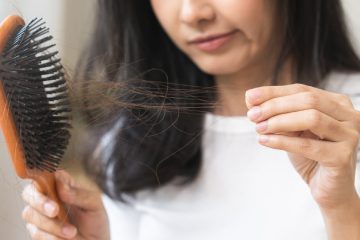 Scalp Micropigmentation